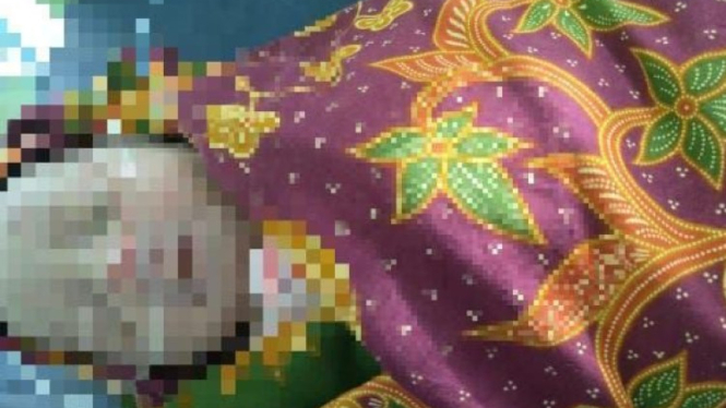 Bayi Perempuan dengan Luka Parah Diduga Diterkam Anjing Ditemukan di Pinggir Jalan Jeneponto